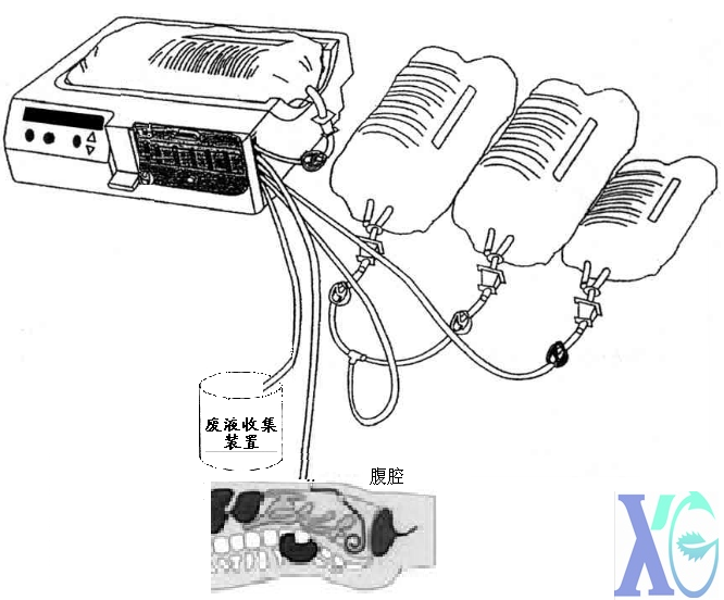 7f93aaff5783ccbafb66edb12bacfd2a.png 7f93aaff5783ccbafb66edb12bacfd2a.png