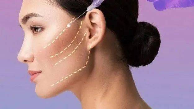 pga和pgla有什么区别西格洞见：埋植线类医疗器械临床试验设计与操作思路_https://www.jmylbn.com_新闻资讯_第1张